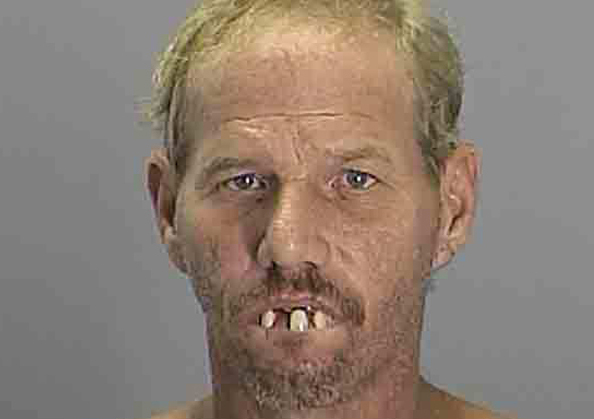 dents